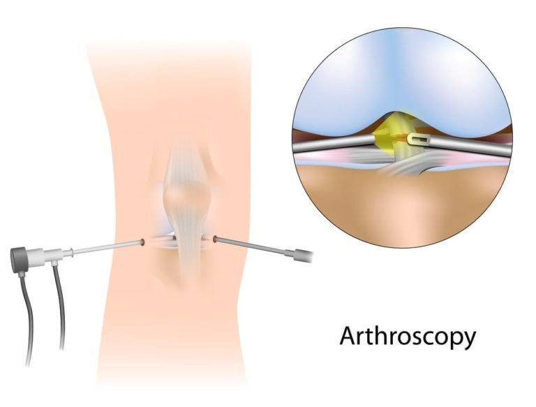 arthroscopy christopher miller orthopedic